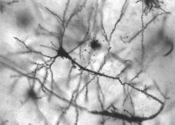 Da Usa e Giappone la scoperta di nuove armi contro l’invecchiamento