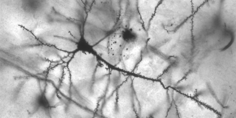 Da Usa e Giappone la scoperta di nuove armi contro l’invecchiamento