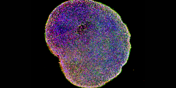 Ad Harvard creati cervelli in vitro utili per la sperimentazione