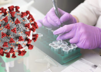 Un nuovo test riconosce il coronavirus in mezz’ora