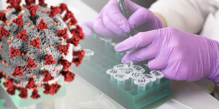 Un nuovo test riconosce il coronavirus in mezz’ora