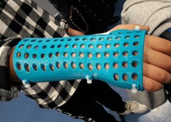 tutori gesso bambini