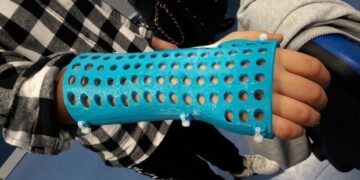 tutori gesso bambini